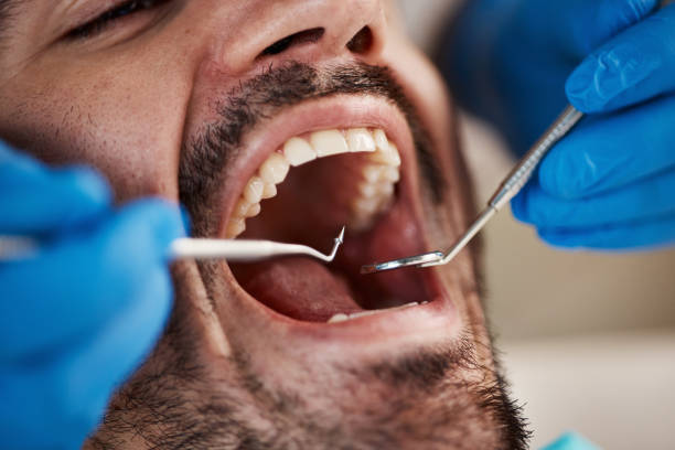 Best Emergency Treatment for Toothache in Seymour, IN