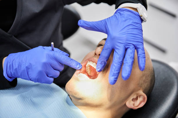 Best Emergency Root Canal Treatment in Seymour, IN
